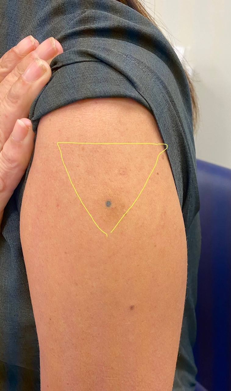 The ECT4Health BLOG KYJ Knowing Your Jargon ECT4Health